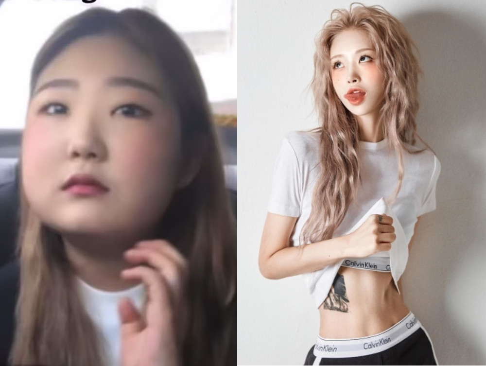 Nữ người mẫu thành công giảm 50 kg để chống trọi căn bệnh Lupus ban đỏ Ảnh 1